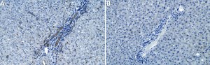 Anti-α Actinin Antibody, clone AT6/172 ZooMAb® Mouse Monoclonal recombinant, expressed in HEK 293 cells