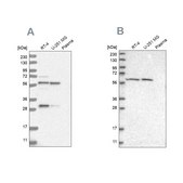 Anti-PAH antibody produced in rabbit Prestige Antibodies® Powered by Atlas Antibodies, affinity isolated antibody, buffered aqueous glycerol solution