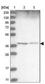 Anti-WDR92 antibody produced in rabbit Prestige Antibodies® Powered by Atlas Antibodies, affinity isolated antibody, buffered aqueous glycerol solution