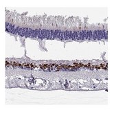 Anti-VSX2 antibody produced in rabbit Prestige Antibodies® Powered by Atlas Antibodies, affinity isolated antibody, buffered aqueous glycerol solution