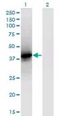 Monoclonal Anti-LCAT antibody produced in mouse clone 4A9, purified immunoglobulin, buffered aqueous solution