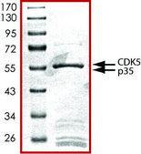 CDK5/p35., active, GST tagged human PRECISIO® Kinase, recombinant, expressed in baculovirus infected Sf9 cells, ≥70% (SDS-PAGE), buffered aqueous glycerol solution