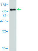 Monoclonal Anti-CDK5RAP3 antibody produced in mouse clone 1G4, purified immunoglobulin, buffered aqueous solution