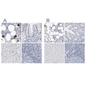 Anti-ITGA2B antibody produced in rabbit Prestige Antibodies® Powered by Atlas Antibodies, affinity isolated antibody, buffered aqueous glycerol solution