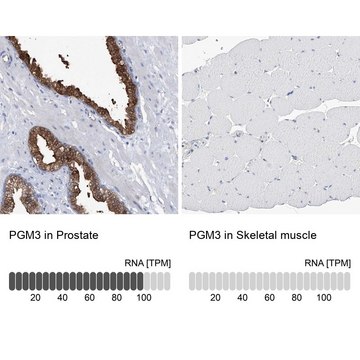 Anti-PGM3 antibody produced in rabbit Prestige Antibodies® Powered by Atlas Antibodies, affinity isolated antibody, buffered aqueous glycerol solution, ab1