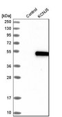 Anti-KCNJ5 antibody produced in rabbit Prestige Antibodies® Powered by Atlas Antibodies, affinity isolated antibody, buffered aqueous glycerol solution