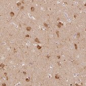 Anti-MAP1LC3A antibody produced in rabbit Prestige Antibodies® Powered by Atlas Antibodies, affinity isolated antibody, buffered aqueous glycerol solution