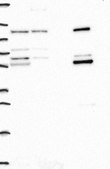 Anti-ALDH1B1 antibody produced in rabbit Prestige Antibodies® Powered by Atlas Antibodies, affinity isolated antibody, buffered aqueous glycerol solution