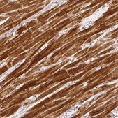 Monoclonal Anti-RHOT1 antibody produced in mouse Prestige Antibodies® Powered by Atlas Antibodies, clone CL1083, purified immunoglobulin, buffered aqueous glycerol solution