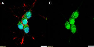 Anti-TBR1 Antibody, clone 1D16 ZooMAb® Rabbit Monoclonal recombinant, expressed in HEK 293 cells