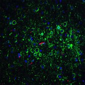 Anti-Bcl-2 (ab1) antibody produced in rabbit affinity isolated antibody, buffered aqueous solution
