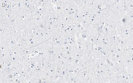 Anti-VGLUT2 Antibody, clone 8G9.2 ZooMAb® Mouse Monoclonal recombinant, expressed in HEK 293 cells