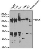 Anti-EEF2K antibody produced in rabbit