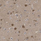 Anti-FIS1 antibody produced in rabbit Prestige Antibodies® Powered by Atlas Antibodies, affinity isolated antibody, buffered aqueous glycerol solution