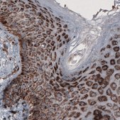 Monoclonal Anti-CS antibody produced in mouse Prestige Antibodies® Powered by Atlas Antibodies, clone CL2579, purified immunoglobulin, buffered aqueous glycerol solution