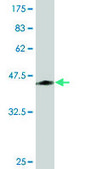Monoclonal Anti-ORM1 antibody produced in mouse clone 2F9-1F10, purified immunoglobulin, buffered aqueous solution