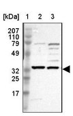 Anti-SLC25A21 antibody produced in rabbit Prestige Antibodies® Powered by Atlas Antibodies, affinity isolated antibody, buffered aqueous glycerol solution