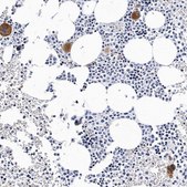 Anti-ITGA2B antibody produced in rabbit Prestige Antibodies® Powered by Atlas Antibodies, affinity isolated antibody, buffered aqueous glycerol solution