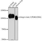 Anti-Integrin beta 3 (ITGB3/CD61) Antibody, clone 7D5N1, Rabbit Monoclonal