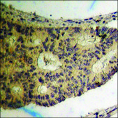 抗 磷酸化 hnRNP K (pSer 284 ) 兔抗 affinity isolated antibody
