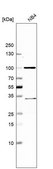 Anti-KCND1 antibody produced in rabbit Prestige Antibodies® Powered by Atlas Antibodies, affinity isolated antibody, buffered aqueous glycerol solution