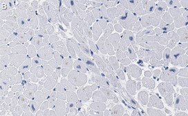 Anti-SDHB Antibody, clone 1H11 ZooMAb® Rabbit Monoclonal recombinant, expressed in HEK 293 cells