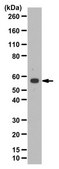 Anti-Calcineurin A/PP2B catalytic unit Antibody from rabbit, purified by affinity chromatography