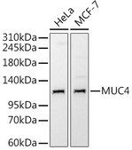 Anti-MUC4 Antibody, clone 5J3R7, Rabbit Monoclonal