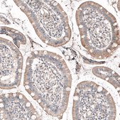 Monoclonal Anti-ROR2 antibody produced in mouse Prestige Antibodies® Powered by Atlas Antibodies, clone CL5950, purified immunoglobulin, buffered aqueous glycerol solution