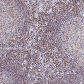 Anti-PIK3CD antibody produced in rabbit Prestige Antibodies® Powered by Atlas Antibodies, affinity isolated antibody, buffered aqueous glycerol solution