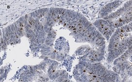 Anti-phospho-Smad2 (Ser465/467) Antibody, clone A5S, ZooMAb® Rabbit Monoclonal recombinant, expressed in HEK 293 cells