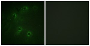 Anti-DAPK1 antibody produced in rabbit affinity isolated antibody