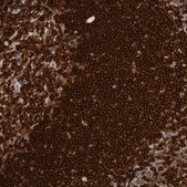 Anti-PTPN6 antibody produced in rabbit Prestige Antibodies® Powered by Atlas Antibodies, affinity isolated antibody, buffered aqueous glycerol solution