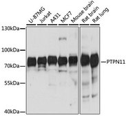 Anti-PTPN11 antibody produced in rabbit