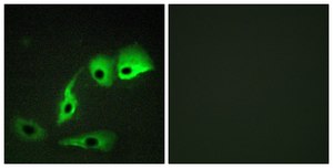 Anti-Calmodulin antibody produced in rabbit affinity isolated antibody