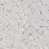 Anti-PTPN6 antibody produced in rabbit Prestige Antibodies® Powered by Atlas Antibodies, affinity isolated antibody, buffered aqueous glycerol solution