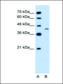 Anti-DHODH (AB2) antibody produced in rabbit affinity isolated antibody