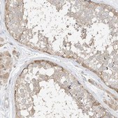 Anti-ETHE1 antibody produced in rabbit Prestige Antibodies® Powered by Atlas Antibodies, affinity isolated antibody, buffered aqueous glycerol solution, ab2