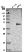Anti-QPCT antibody produced in rabbit Prestige Antibodies® Powered by Atlas Antibodies, affinity isolated antibody, buffered aqueous glycerol solution