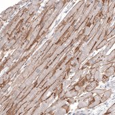 Monoclonal Anti-LAMA2 antibody produced in mouse Prestige Antibodies® Powered by Atlas Antibodies, clone CL3450, purified immunoglobulin, buffered aqueous glycerol solution