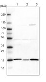Anti-ATP5D antibody produced in rabbit Prestige Antibodies® Powered by Atlas Antibodies, affinity isolated antibody, buffered aqueous glycerol solution