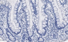 Anti-Caspase-7 Antibody, clone 1E21 ZooMAb® Rabbit Monoclonal recombinant, expressed in HEK 293 cells