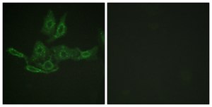抗-BCL-2 兔抗 affinity isolated antibody