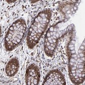 Anti-EP300 antibody produced in rabbit Ab1, Prestige Antibodies® Powered by Atlas Antibodies, affinity isolated antibody, buffered aqueous glycerol solution