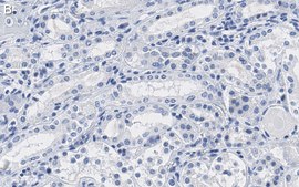 Anti-Na+/K+ ATPase α-1 Antibody, clone C464.6 ZooMAb® Mouse Monoclonal recombinant, expressed in HEK 293 cells