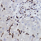 Anti-L-Plastin/LCP1 Antibody, clone 3T0M1, Rabbit Monoclonal