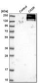 Anti-CASR antibody produced in rabbit Prestige Antibodies® Powered by Atlas Antibodies, affinity isolated antibody, buffered aqueous glycerol solution