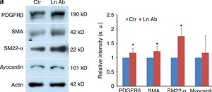Anti-Actin, α-Smooth Muscle - FITC antibody, Mouse monoclonal clone 1A4, purified from hybridoma cell culture
