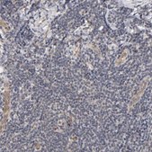 Anti-LAMB1 antibody produced in rabbit Prestige Antibodies® Powered by Atlas Antibodies, affinity isolated antibody, buffered aqueous glycerol solution