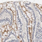 Anti-SLC10A2 antibody produced in rabbit Prestige Antibodies® Powered by Atlas Antibodies, affinity isolated antibody, buffered aqueous glycerol solution